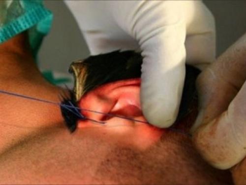 На днях лицо собаки было пересажено одному австралийскому художнику. 02