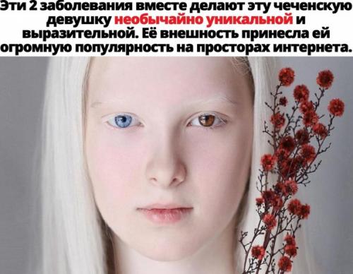 Зачем рано ложиться и рано вставать? 02 Зачем рано ложиться и рано вставать? 02