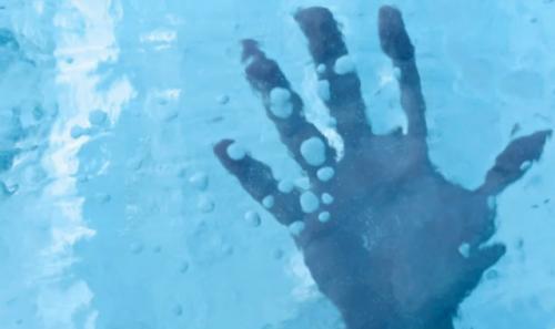 Якутские врачи вывели человека из 