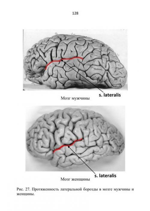 Мозг мужчин различия. Мозг мужчины и женщины. Мозг женщины. Мозг мужчины. Мужской и женский мозг.