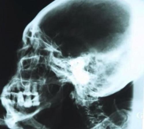 В перу возле плато наска нашли странную мумию. 05