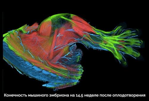 Пocт любования чудесами технологий микроскопического исследования окружающего мира. 07