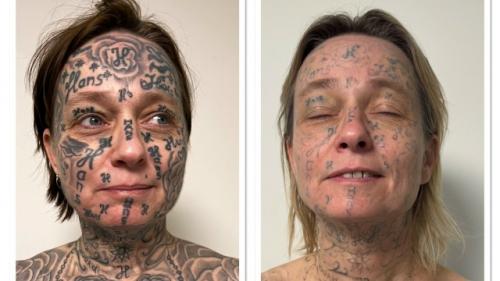 53-Летняя Джоке - одна из многих женщин, которым помог фонд Spijt van Tattoo, основанный в Роттердаме. 02 53-Летняя Джоке - одна из многих женщин, которым помог фонд Spijt van Tattoo, основанный в Роттердаме. 02
