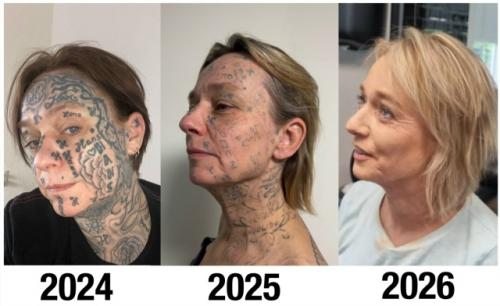 53-Летняя Джоке - одна из многих женщин, которым помог фонд Spijt van Tattoo, основанный в Роттердаме. 06 53-Летняя Джоке - одна из многих женщин, которым помог фонд Spijt van Tattoo, основанный в Роттердаме. 06