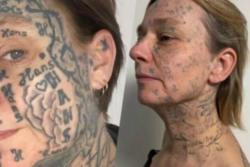 53-Летняя Джоке - одна из многих женщин, которым помог фонд Spijt van Tattoo, основанный в Роттердаме. 01 53-Летняя Джоке - одна из многих женщин, которым помог фонд Spijt van Tattoo, основанный в Роттердаме. 01