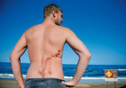 Не является редкостью спасение человека дельфинами от утопления.  