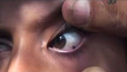 10 медицинских загадок, которые наука пока не может разгадать.

