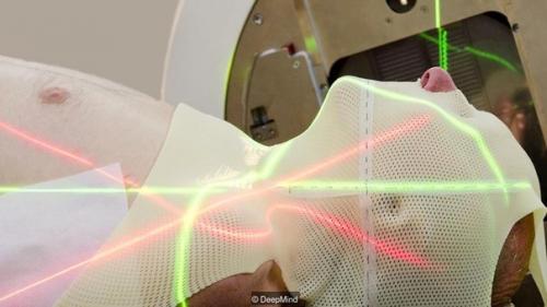 Как искусственный интеллект нас от рака и излишней жестокости защищает. 03 Как искусственный интеллект нас от рака и излишней жестокости защищает. 03