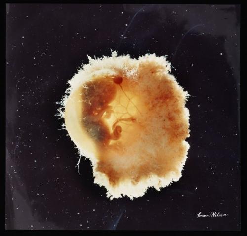 Lennart Nilsson - рождение ребёнка*. 02