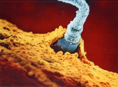 Lennart Nilsson - рождение ребёнка*.