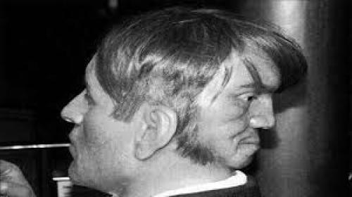 19-Ом в. в Англии жил человек со вторым лицом на затылке. 02