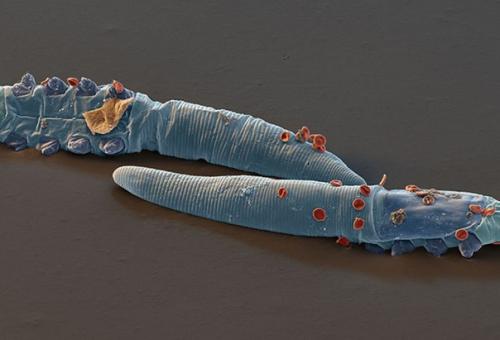 Вызывающий прыщи человеческий клещ по наследству передается.

