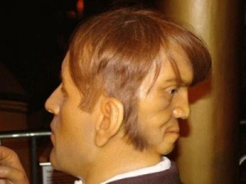 19-Ом в. в Англии жил человек со вторым лицом на затылке. 01