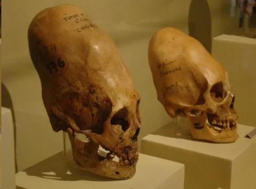 Почему у древних египтян была такая странная форма головы? 01