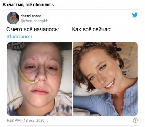 10 людей поделились своими историями борьбы с раком, показав, с чего начался их трудный путь, и как всё сейчас. 02