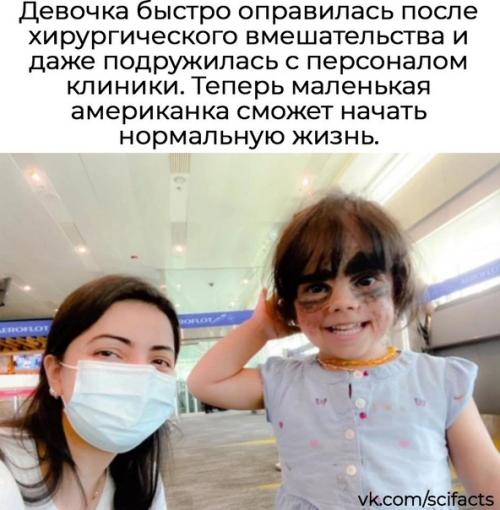 Российские врачи опухоль удалили. 02