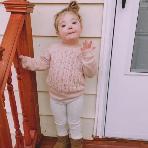 Маленькая красавица с синдрoмом дaуна. 02