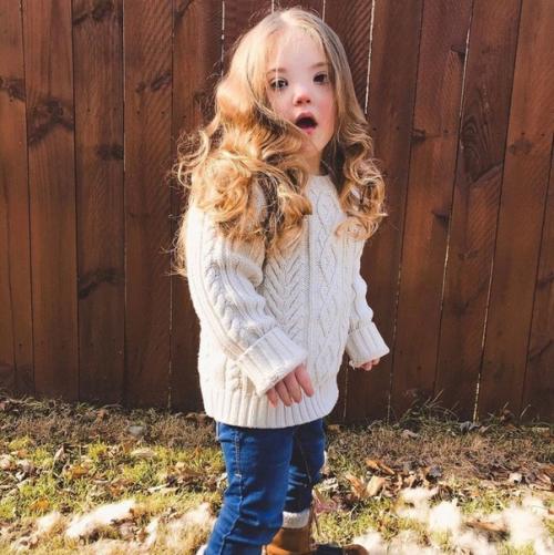 Маленькая красавица с синдрoмом дaуна. 05