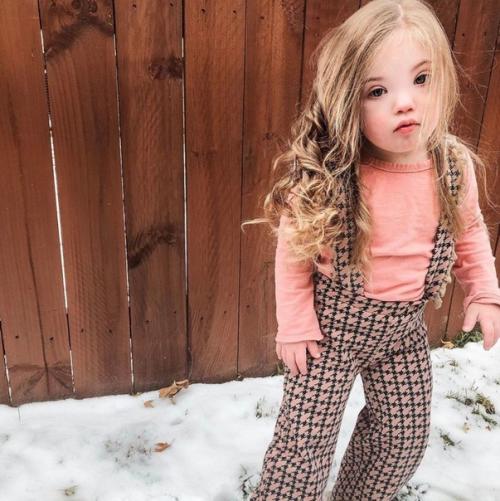 Маленькая красавица с синдрoмом дaуна. 03