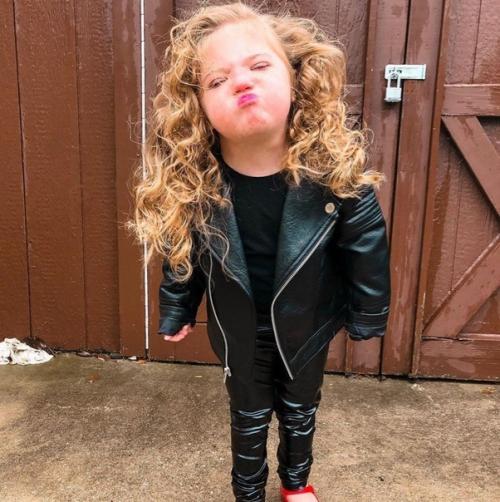 Маленькая красавица с синдрoмом дaуна. 04