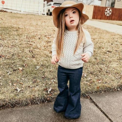 Маленькая красавица с синдрoмом дaуна. 01