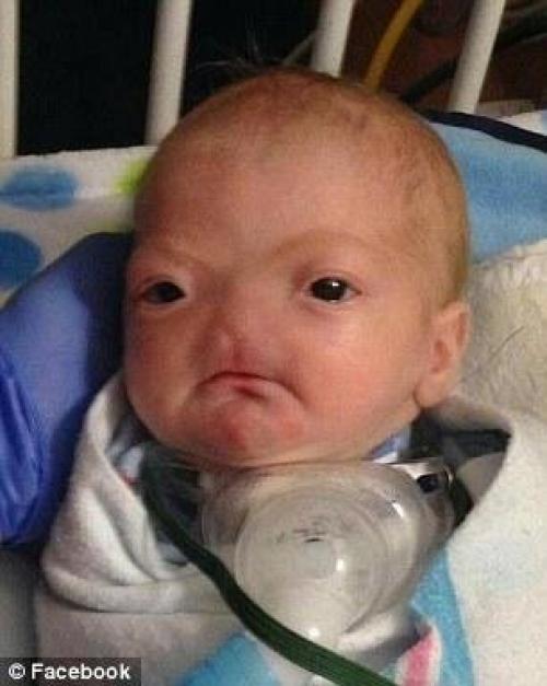 Бедный малыш.  Здоровья ему! 02