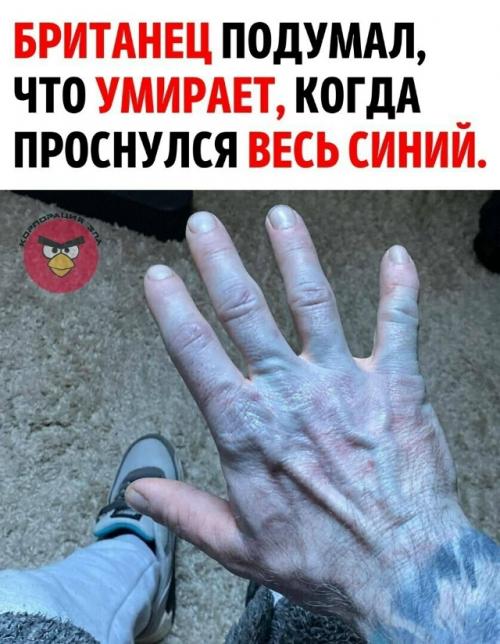 Британец, проснувшись утром, обнаружил, что полностью посинел.  