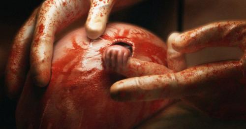 Как выглядит сегодня мальчик со знаменитого фото 