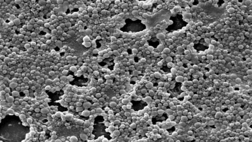 Не радиация и не холод: главная опасность для человека в космическом пространстве. 01