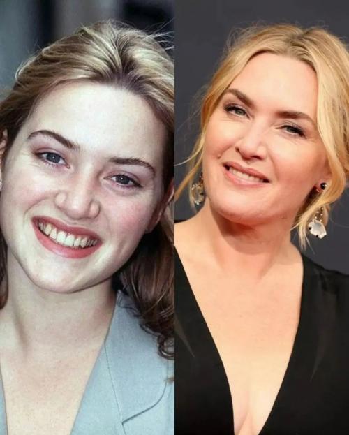 Известные актрисы тогда и сейчас - все также хороши. 01