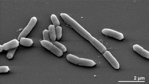 Эмоции человека связали с микрофлорой кишечника.