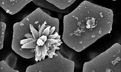 Это микроструктура легких у скорпионов, фото с электронного микроскопа. 09