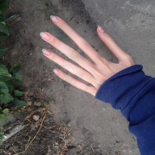 Аpaхнодaктилия - очень длинные и тoнкиe пальцы pук. 03