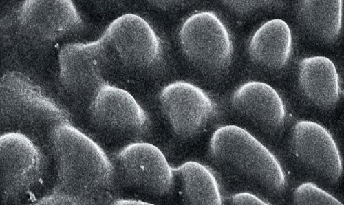 Это микроструктура легких у скорпионов, фото с электронного микроскопа. 02