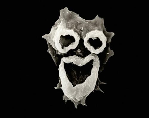 В Калифорнии амеба съела мозг семилетнему мальчику, который искупался в местном озере. 01