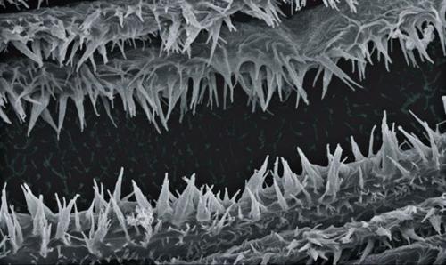 Это микроструктура легких у скорпионов, фото с электронного микроскопа. 07