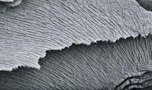 Это микроструктура легких у скорпионов, фото с электронного микроскопа. 05