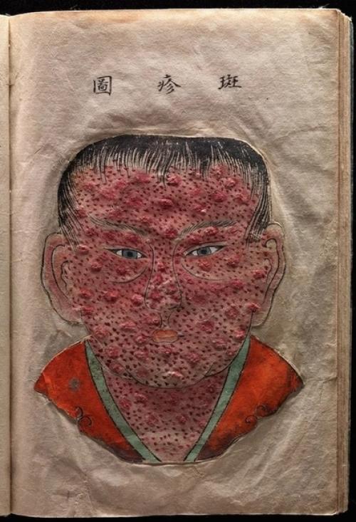 Уникальный трехмерный медицинский атлас японского врача канда генсен, конец 17 века. 02