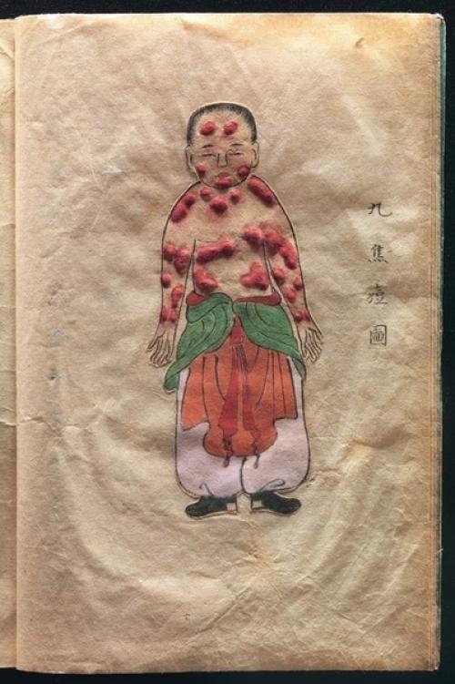 Уникальный трехмерный медицинский атлас японского врача канда генсен, конец 17 века. 01