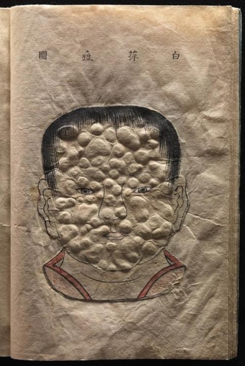 Уникальный трехмерный медицинский атлас японского врача канда генсен, конец 17 века. 05