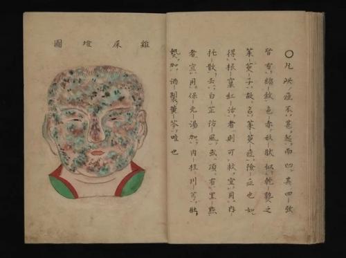 Уникальный трехмерный медицинский атлас японского врача канда генсен, конец 17 века. 06