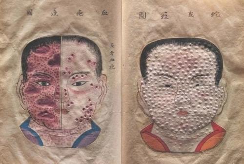 Уникальный трехмерный медицинский атлас японского врача канда генсен, конец 17 века. 03