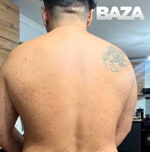 Турист заразился серьёзной инфекцией во время обряда очищения в священном источнике на Бали. 01