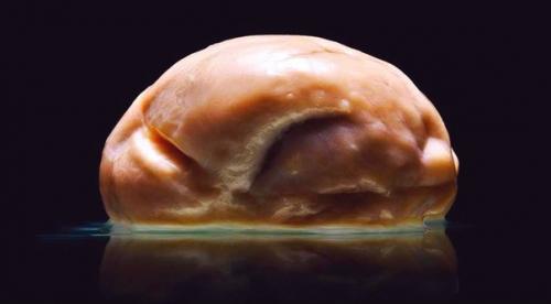 Это редчайший мозг взрослого человека с аригией - врожденным отсутствием извилин (агирия.  