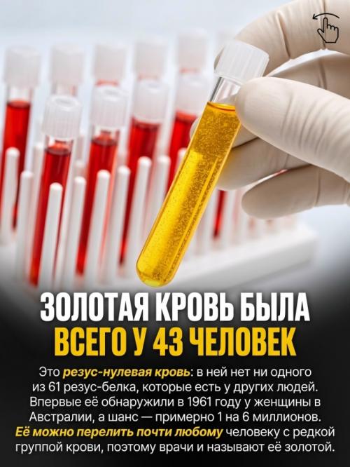 Природа раздаёт людям особенности внешности с такой разницей в шансах, что некоторые почти невозможно встретить. 05