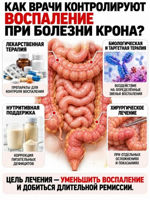 На верхней фотографии показан один из самых узнаваемых признаков болезни крона - так называемая Булыжная Мостовая слизистой кишечника. 06