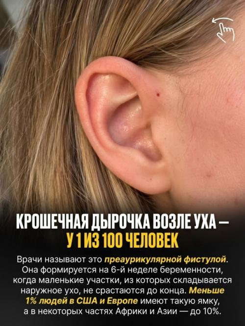 Природа раздаёт людям особенности внешности с такой разницей в шансах, что некоторые почти невозможно встретить. 01