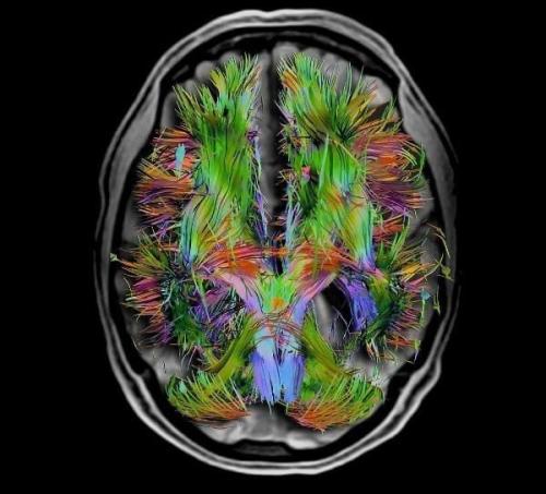 Вот так выглядят ваши мысли на картинке. 04