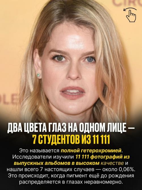 Природа раздаёт людям особенности внешности с такой разницей в шансах, что некоторые почти невозможно встретить. 04