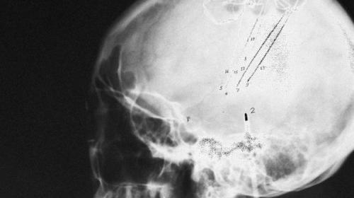 Научное крыло пентагона разработало чип для кодировки воспоминаний.